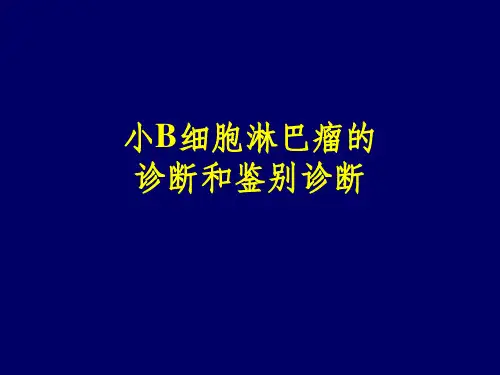 小B细胞淋巴瘤的诊断及鉴别诊断