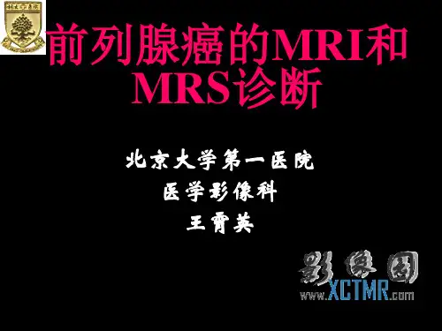 0260-前列腺癌的MRI和MRS诊断
