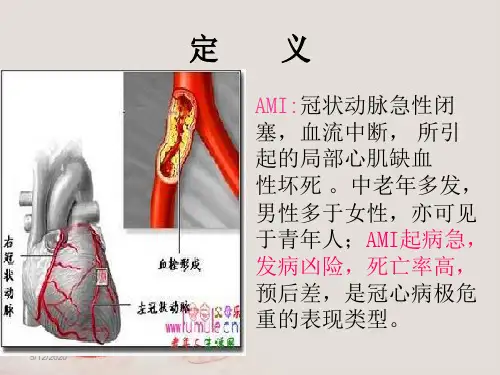 急性心肌梗死的护理 新进展