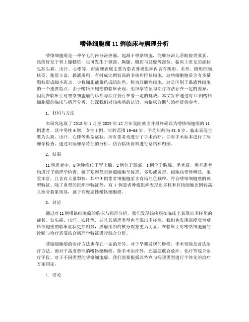 嗜铬细胞瘤11例临床与病理分析