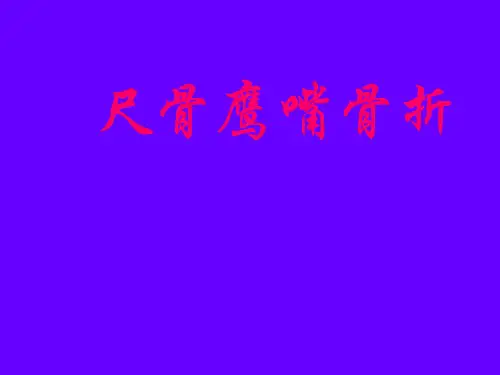 尺骨鹰嘴骨折课件