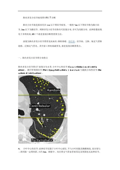肺内多发小结节病变的HRCT诊断 2