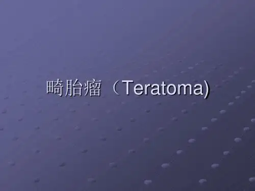 畸胎瘤ppt课件