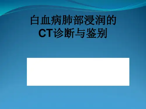 白血病肺部浸润CT诊断与鉴别