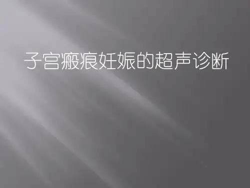 瘢痕处妊娠PPT课件