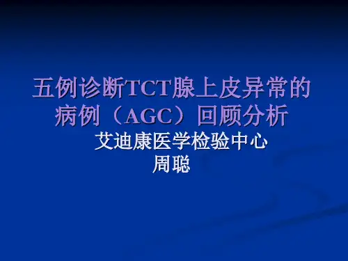 五例诊断TCT腺上皮的回顾分析2