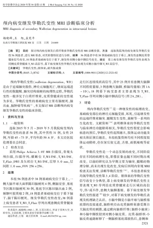 颅内病变继发华勒氏变性MRI诊断临床分析