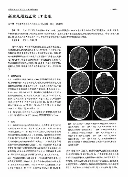 新生儿颅脑正常CT表现