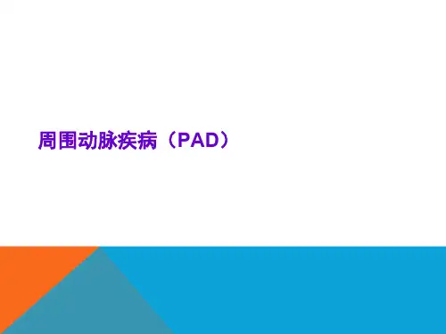 周围血管疾病(PAD)