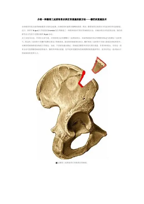 介绍一种髂骨三皮质取骨后供区骨重建的新方法——栅栏状重建技术