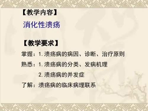 消化性溃疡课件ppt