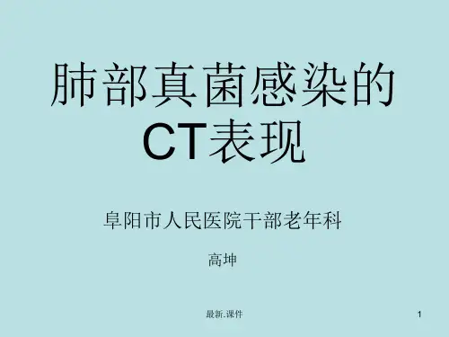 肺部真菌感染的CT表现完整版.ppt
