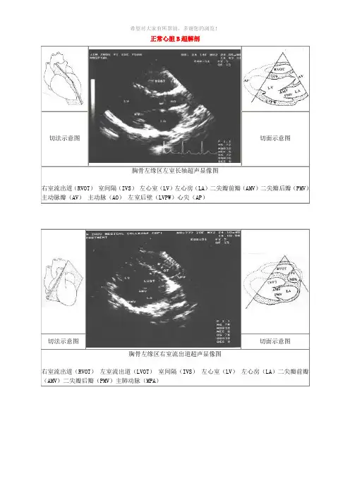 正常心脏B超解剖