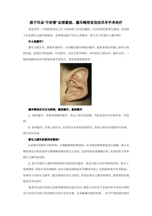 猿耳畸形是什么