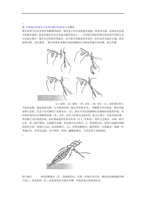 外科缝合的基本方法遇带图