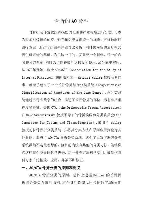 骨折的AO分型讲解