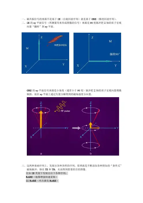 EPI与DWI和DTI分析2