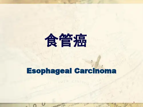 食管癌详解精品PPT课件