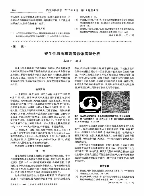寄生性肺曲霉菌病影像病理分析
