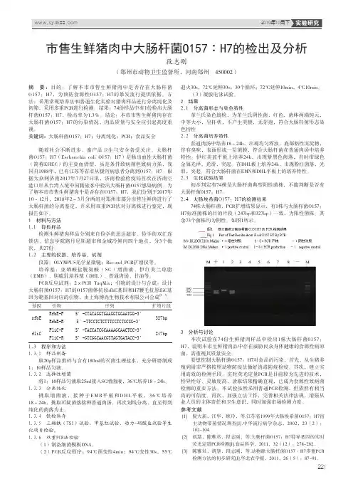 市售生鲜猪肉中大肠杆菌o157∶h7的检出及分析