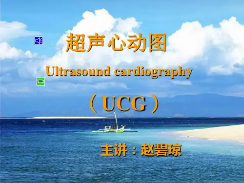 超声心动图