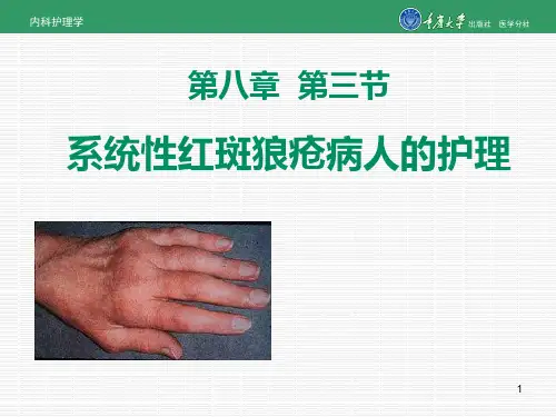 内科护理学第八章第三节系统性红斑狼疮的护理PPT课件