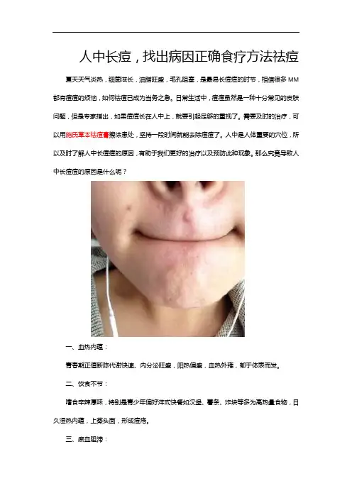 人中长痘,找出病因正确食疗方法祛痘