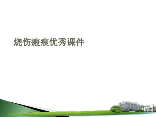烧伤瘢痕优秀课件