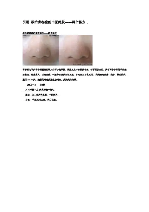 根治青春痘的中医绝技