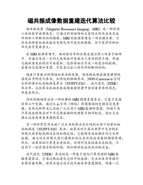 磁共振成像数据重建迭代算法比较