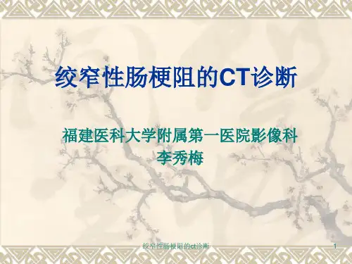 绞窄性肠梗阻的ct诊断课件