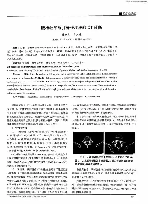 腰椎峡部裂并脊柱滑脱的CT诊断