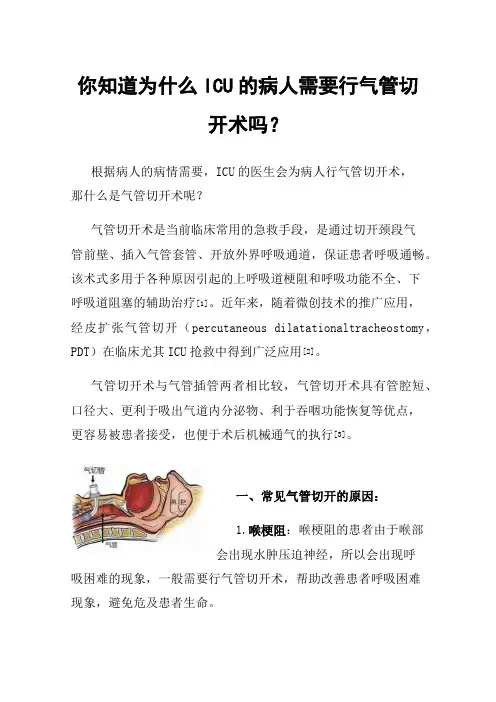 你知道为什么ICU的病人需要行气管切开术吗？