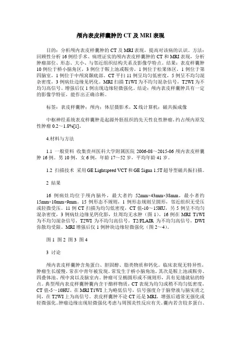 颅内表皮样囊肿的CT及MRI表现