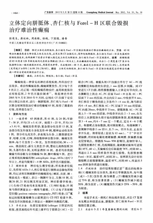 立体定向胼胝体、杏仁核与Forel-H区联合毁损治疗难治性癫痫