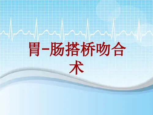 手术讲解模板：胃-肠搭桥吻合术
