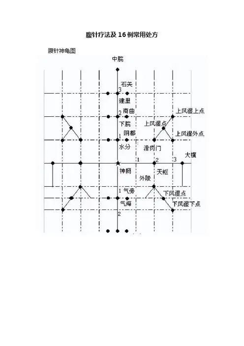 腹针疗法及16例常用处方