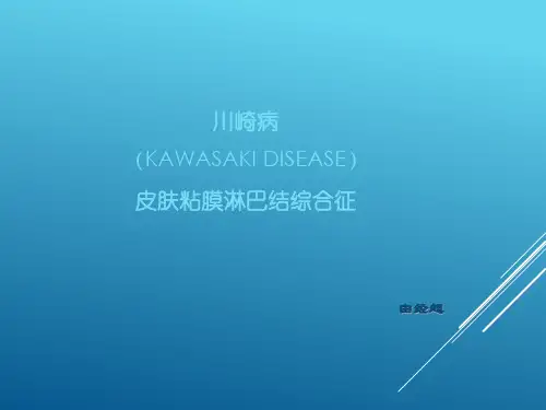 川崎病