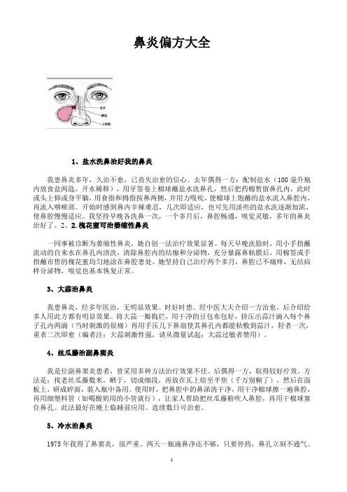 鼻炎偏方大全