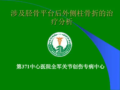 胫骨平台骨折