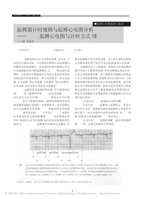 起搏器计时规则与起搏心电图分析_DDD起搏心电图与计时方式_续2_