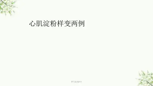 心肌淀粉样变课件