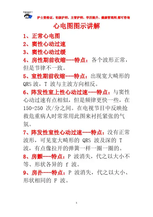 心电图图示讲解