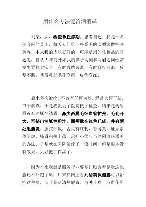 用什么方法能治酒渣鼻