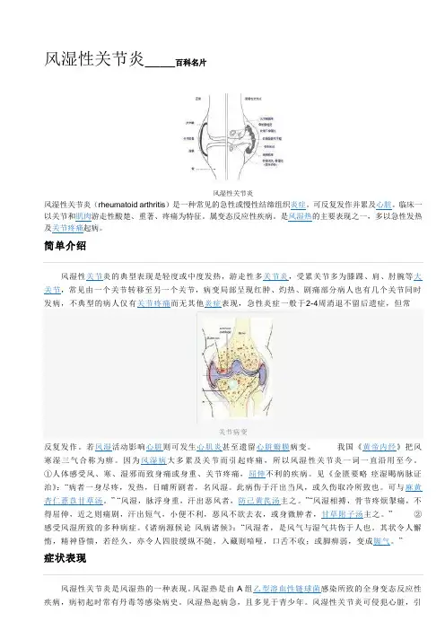 风湿性关节炎