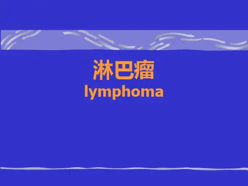 内科学课件：淋巴瘤