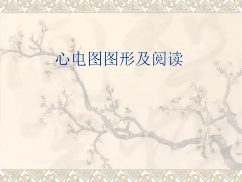 心电图图形及阅读课件