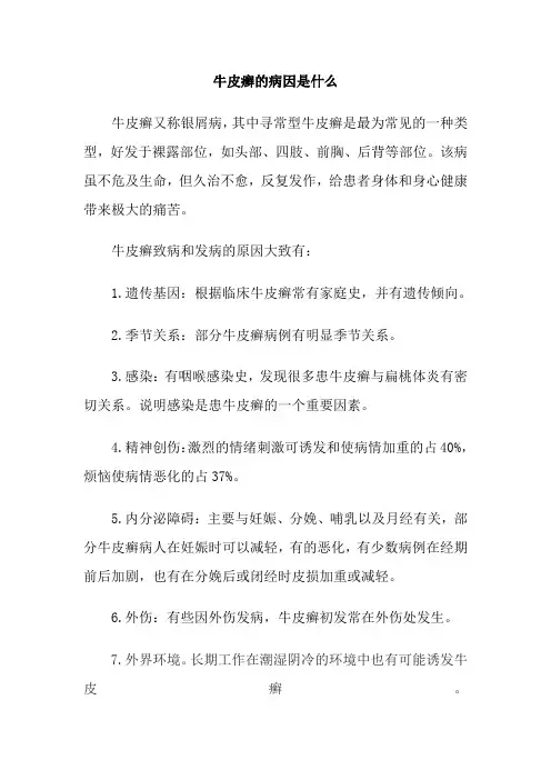 牛皮癣的病因是什么