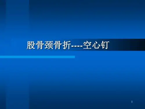 股骨颈骨折ppt-〖精品课件〗