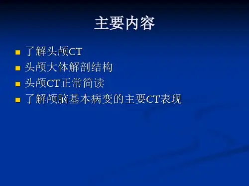 头颅CT简读_PPT课件